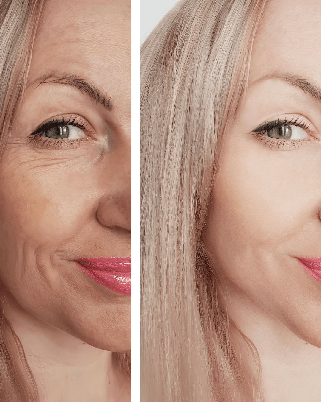 Anti-Aging · Fältchen reduziert — Microneedling Heilbronn C&C Beauty